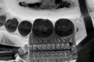 zahnbuersteneg.richtig